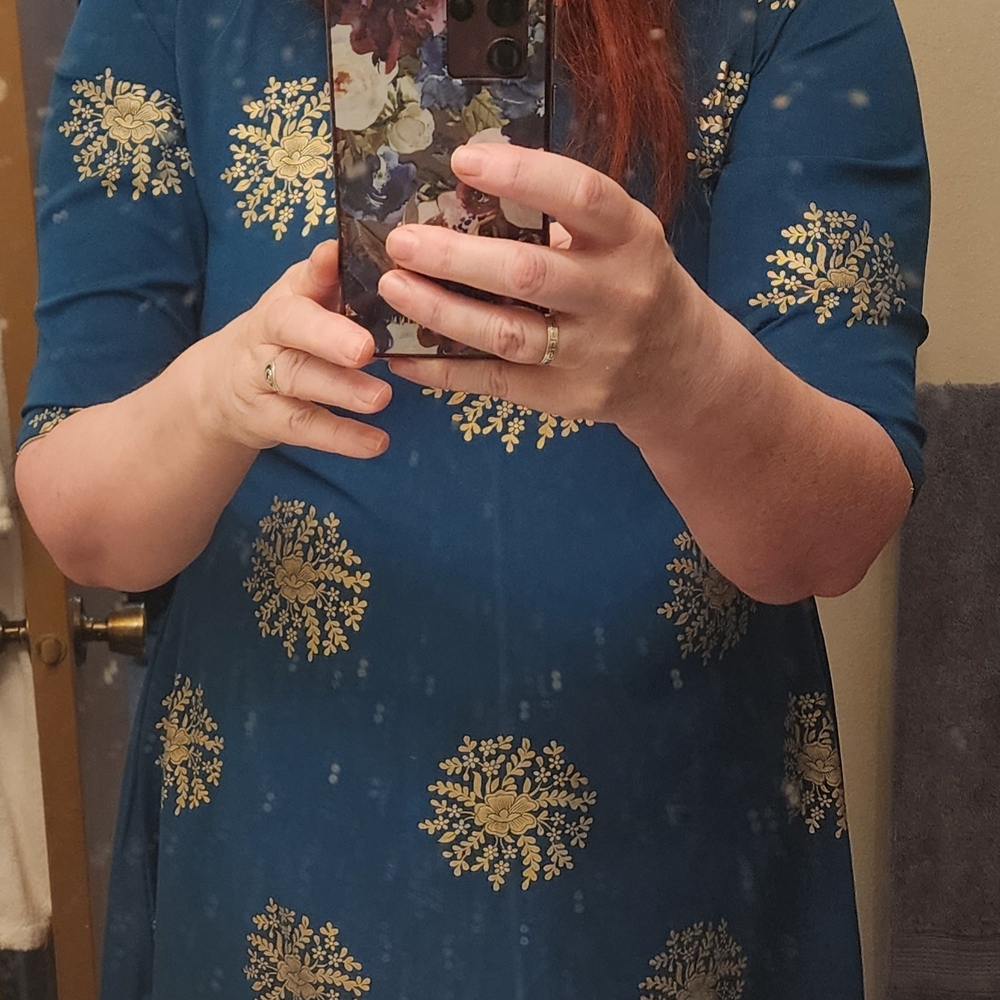 Casual Blue and Gold A-Line Midi Dress with Cuffed Sleeves